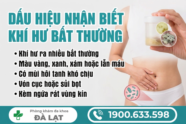 Hình ảnh minh họa